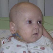 GRAYSON MARC GRANDMONT Obituary pic