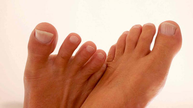 istock
Cracked, dry feet can be soothed with a foot bath and body lotion.