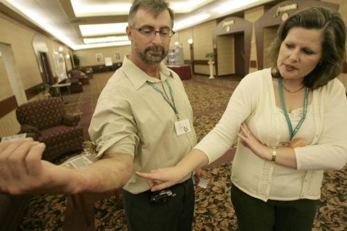John Woods / Winnipeg Free Press / October 7, 2006 - 061007 - Barbara-Anne Hodge, occupational therapist, shows reporter skin grafts on Stan Chuchmuch's arm at the 9th annual Mamingwey Burn Survivor Conference in Winnipeg Saturday Oct 7/06.