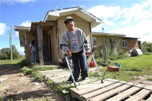 30 year old Kevin Taylor who has Cerebral palsy makes his way to the outhouse on  his crutches in his home in St Theresa Point First Nation- His mother Alice has filled a Human Rights  to  get proper services for her son on the reservation. Their home has no running water- See Mary Agnes No Running Water Feature  August 19, 2011   (JOE BRYKSA / WINNIPEG FREE PRESS)