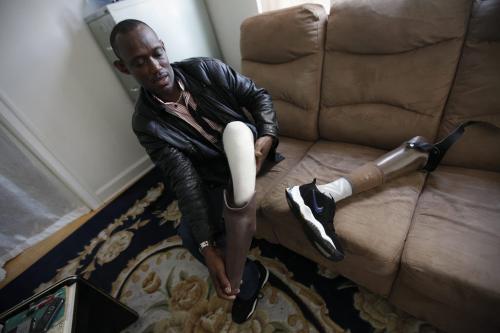 June 18, 2012 - 120618 - Cyrilo Simpunga, a recent refugee from the Congo, is photographed putting on his artificial leg in his downtown apartment in Winnipeg Monday June 12, 2012. Simpunga had his left leg cut off during the Congo civil war in 2004. John Woods / Winnipeg Free Press