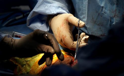 Surgeons suture a knee replacement in Managua. Phil Hossack / Winnipeg Free Press October 25, 2012