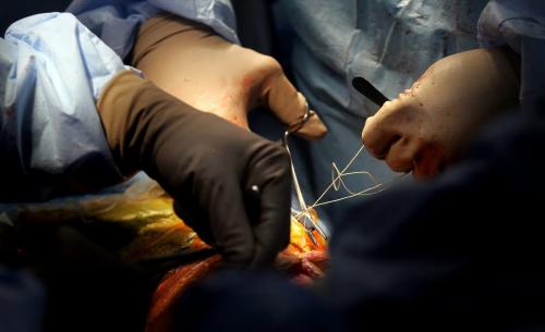 Surgeons suture a knee replacement in Managua.  Phil Hossack / Winnipeg Free Press  October 25, 2012