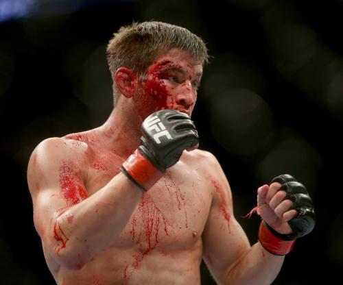 Sam Stout was badly cut by a shin during his bout with James Krause at UFC 161 in Winnipeg, Manitoba, Saturday, June 15, 2013. (TREVOR HAGAN/WINNIPEG FREE PRESS)