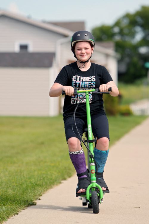 Mattie Noto, 12, rides a motorized scooter along the sidewalk on Young Ave. while sporting casts on both of her legs on Monday. Noto had surgery on her legs earlier in the summer and Monday was her first day trying out the scooter. She gets her casts off in one week.  (Tim Smith/Brandon Sun)
