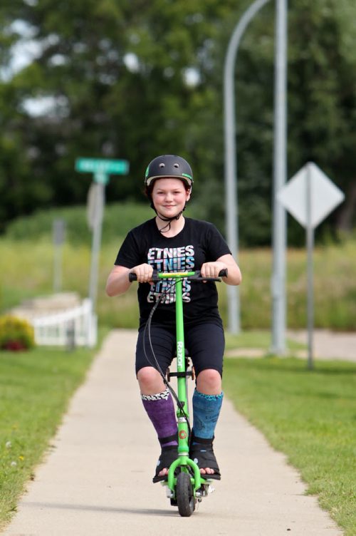 Brandon Sun 08042013 Mattie Noto, 12, rides a motorized scooter along the sidewalk on Young Ave. while sporting casts on both of her legs on Monday. Noto had surgery on her legs earlier in the summer and Monday was her first day trying out the scooter. She gets her casts off in one week.  (Tim Smith/Brandon Sun)