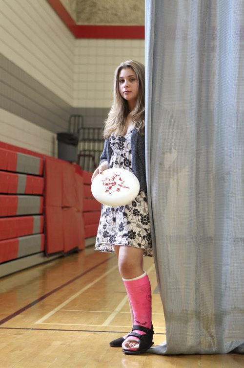 Mackenzie had to give up her favourite game, ultimate frisbee after breaking a bone in her left leg.  Former Windsor School students face new challenges and take on new responsibilities in their first year in grade nine at Glen Lawn Collegiate. See Doug Speirs story. June 04, 2014 Ruth Bonneville / Winnipeg Free Press