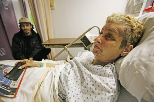 John Woods / Winnipeg Free Press / September 24, 2007 - 070924  - Mary Ewing, Winnipeg Free Press carrier, lies injured in her hospital bed Monday, September 24/07 suffering from leg and head injuries after the driver of a car swerved into her hitting her head-on early Saturday morning as she was starting her delivery route.   Her son Jason was visiting her.