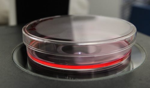 University of Manitoba Professor Afshin Raouf is a researcher who specializes in isolating and assessing healthy breast cells and cancer cells. A petri dish holds living breast cells. 150512 - Tuesday, May 12, 2015 -  (MIKE DEAL / WINNIPEG FREE PRESS)