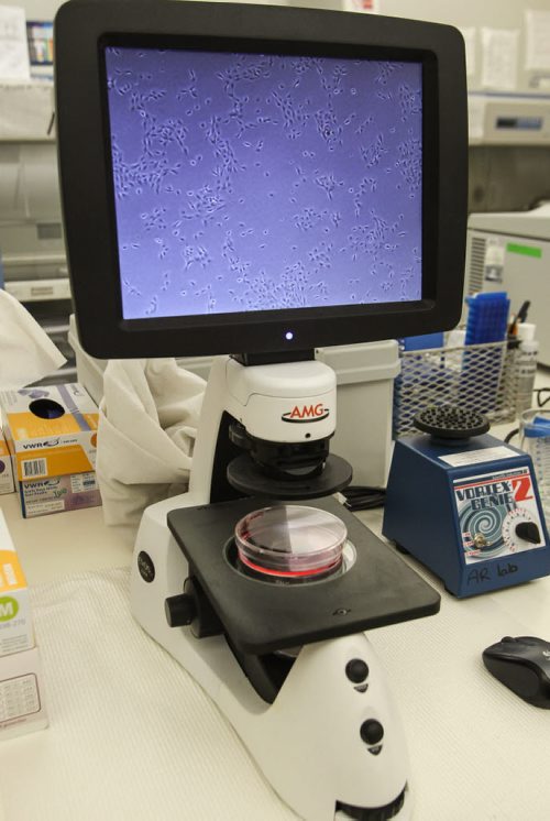 University of Manitoba Professor Afshin Raouf is a researcher who specializes in isolating and assessing healthy breast cells and cancer cells. The microscope shows living breast cells that are grown in petri dishes. 150512 - Tuesday, May 12, 2015 -  (MIKE DEAL / WINNIPEG FREE PRESS)