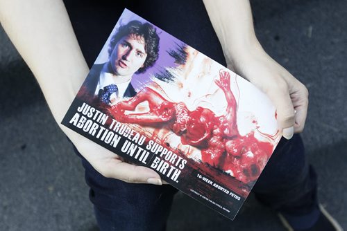 July 21, 2015 - 150721  -  Toby Cygman is photographed on her front steps with a brochure informing home owners of Justin Trudeau's position on abortion Tuesday July 21, 2015. Cygman is upset about the graphic content and feels the content is hate mail. John Woods / Winnipeg Free Press