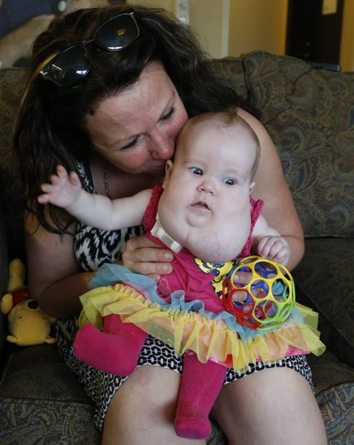 Melanie Finnimore  with her baby daughter Joy, the girl has a congenital birth defect. They are in the Ronald McDonald House Manitoba in the Children's Hospital HSC.  Alex Paul story  Wayne Glowacki / Winnipeg Free Press Sept.4  2015