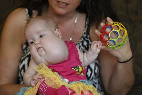 Melanie Finnimore with her baby daughter Joy, the girl has a congenital birth defect. They are in the Ronald McDonald House Manitoba in the Children's Hospital HSC.  Alex Paul story  Wayne Glowacki / Winnipeg Free Press Sept.4  2015