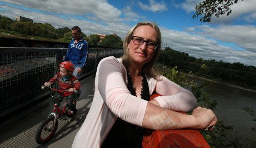 Yoko Chapman poses on the pedestrian walkway where she gashed her arm on a "love lock". The wound required 21 stotches.  See Gord Sinclair story. September 9, 2015 - (Phil Hossack / Winnipeg Free Press)