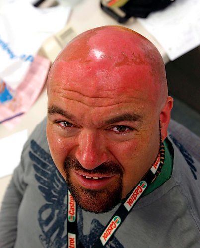 BORIS MINKEVICH / WINNIPEG FREE PRESS  080625 WILLY WITH SUNBURN ON HIS HEAD.