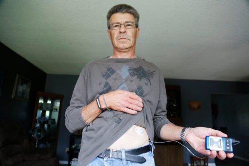 JUSTIN SAMANSKI-LANGILLE / WINNIPEG FREE PRESS
Mitch Beauchemin shows off his insulin pump Wednesday. Beauchemin, 58, says the savings from the province's recent cuts to covered blood sugar test strip amounts should be put towards off-setting the cost of other diabetes-related devices such as insulin pumps.
170628 - Wednesday, June 28, 2017.