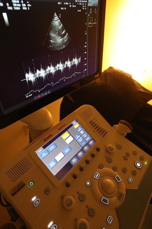 TREVOR HAGAN / WINNIPEG FREE PRESS
Echocardiogram machine at Prota Clinic, Wednesday, December 27, 2017.