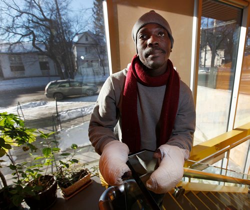 PHIL HOSSACK / Winnipeg Free Press -  36 yr old Kangni Kouevi from Togo who walked across the Emerson border crossing from North Dakota last night. He has severe frostbite to both his hands. Carol Sanders story. - January 8, 2018