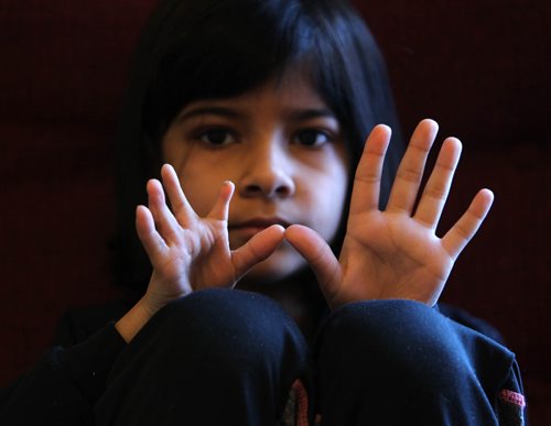 RUTH BONNEVILLE / WINNIPEG FREE PRESS


Portraits of seven-year-old  Kashaf  showing her malformed right hand.  The little girl from Pakistan has a muscular disability where the right half of her body is disfigured and very weak and the malformation includes her right arm and hand which is easily seen in the photo. Her and her dad are at risk of deportation after their refugee claim was rejected 

See Carol Sanders story


Jan 12, 2018

