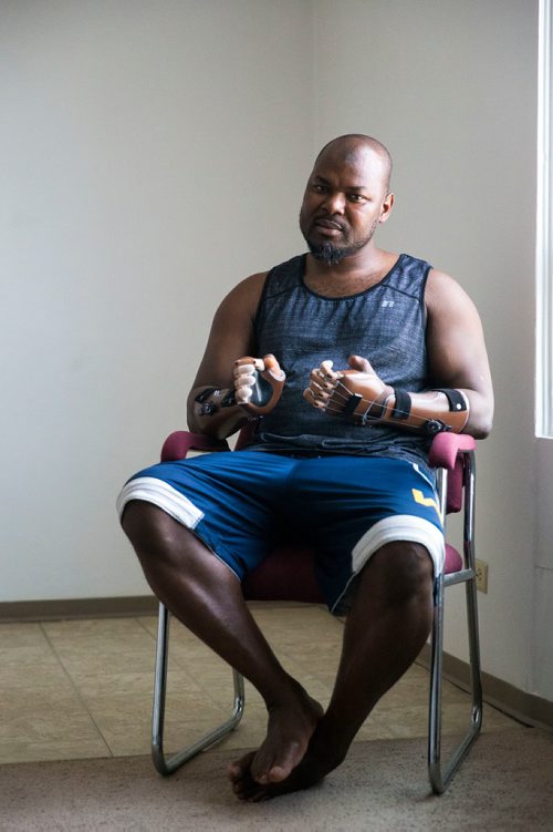MIKAELA MACKENZIE / WINNIPEG FREE PRESS
Ghanaian Razak Iyal, who lost fingers to frostbite crossing the border to Canada, tries out his new prosthetic fingers in Winnipeg on Wednesday, May 23, 2018.  
Mikaela MacKenzie / Winnipeg Free Press 2018.