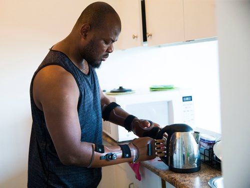 MIKAELA MACKENZIE / WINNIPEG FREE PRESS
Ghanaian Razak Iyal, who lost fingers to frostbite crossing the border to Canada, tries out his new prosthetic fingers in Winnipeg on Wednesday, May 23, 2018.  
Mikaela MacKenzie / Winnipeg Free Press 2018.