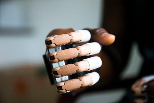 MIKAELA MACKENZIE / WINNIPEG FREE PRESS
Ghanaian Razak Iyal, who lost fingers to frostbite crossing the border to Canada, tries out his new prosthetic fingers in Winnipeg on Wednesday, May 23, 2018.  
Mikaela MacKenzie / Winnipeg Free Press 2018.