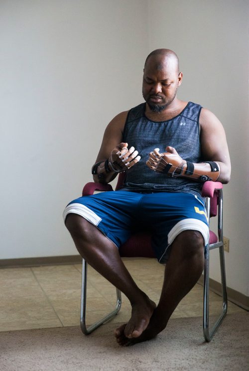 MIKAELA MACKENZIE / WINNIPEG FREE PRESS
Ghanaian Razak Iyal, who lost fingers to frostbite crossing the border to Canada, tries out his new prosthetic fingers in Winnipeg on Wednesday, May 23, 2018.  
Mikaela MacKenzie / Winnipeg Free Press 2018.