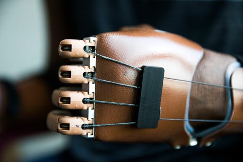 MIKAELA MACKENZIE / WINNIPEG FREE PRESS
Ghanaian Razak Iyal, who lost fingers to frostbite crossing the border to Canada, tries out his new prosthetic fingers in Winnipeg on Wednesday, May 23, 2018.  
Mikaela MacKenzie / Winnipeg Free Press 2018.