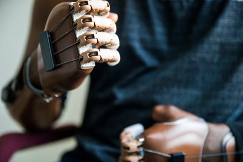 MIKAELA MACKENZIE / WINNIPEG FREE PRESS
Ghanaian Razak Iyal, who lost fingers to frostbite crossing the border to Canada, tries out his new prosthetic fingers in Winnipeg on Wednesday, May 23, 2018.  
Mikaela MacKenzie / Winnipeg Free Press 2018.