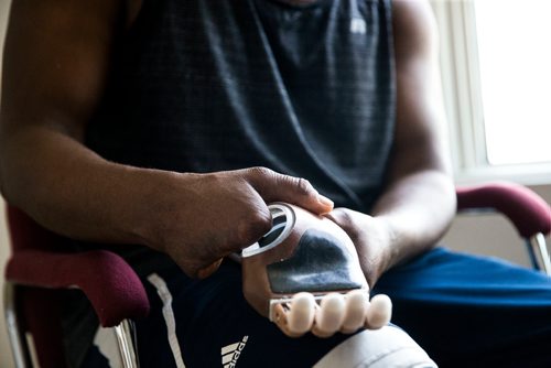 MIKAELA MACKENZIE / WINNIPEG FREE PRESS
Ghanaian Razak Iyal, who lost fingers to frostbite crossing the border to Canada, tries out his new prosthetic fingers in Winnipeg on Wednesday, May 23, 2018.  
Mikaela MacKenzie / Winnipeg Free Press 2018.