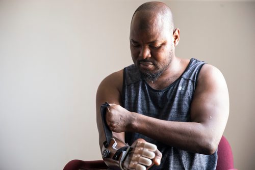 MIKAELA MACKENZIE / WINNIPEG FREE PRESS
Ghanaian Razak Iyal, who lost fingers to frostbite crossing the border to Canada, tries out his new prosthetic fingers in Winnipeg on Wednesday, May 23, 2018.  
Mikaela MacKenzie / Winnipeg Free Press 2018.