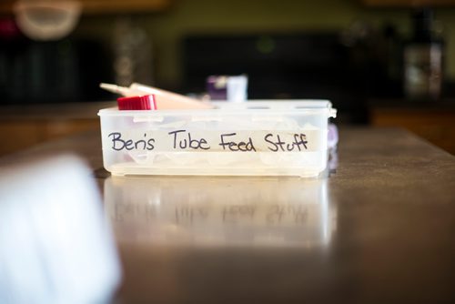 MIKAELA MACKENZIE / WINNIPEG FREE PRESS
Tube feeding supplies are laid out before Benjamin Brubacher gets fed in his group home in Winnipeg on Friday, July 13, 2018. 24hourproject
Mikaela MacKenzie / Winnipeg Free Press 2018.