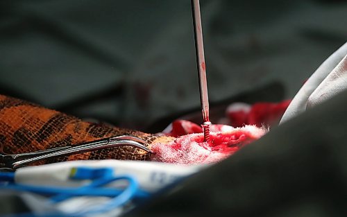 SHANNON VANRAES / WINNIPEG FREE PRESS
Dr. David Scammell uses a sterile screwdriver to remove a broken steel plate from the hind leg of a dog named Peaches at the Winnipeg Animal Emergency Hospital on December 14, 2019.