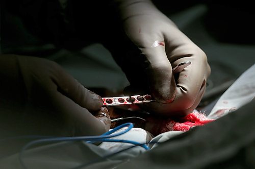 SHANNON VANRAES / WINNIPEG FREE PRESS
Dr. David Scammell removes a broken steel plate from the hind leg of a dog named Peaches at the Winnipeg Animal Emergency Hospital on December 14, 2019.