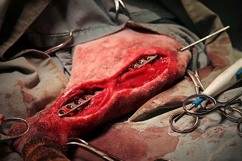 SHANNON VANRAES / WINNIPEG FREE PRESS
A stainless steel rod and plate are used to repair the hind leg of a dog named Peaches at the Winnipeg Animal Emergency Hospital on December 14, 2019. Veterinary staff suspect the dog, which was brought in from Ontario, was hit by a car.