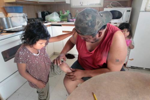 JOE.BRYKSA@FREEPRESS.MB.CA NO RUNNING WATER FEATURE-(See Helen's story)  -   Robert Little  checks his daughter Dayna's knee  on the  Garden Hill First Nation for boils. His family  has contamination problem with cistern that has forced family to boil water after family was getting sick.- July 2010, - JOE BRYKSA/WINNIPEG FREE PRESS