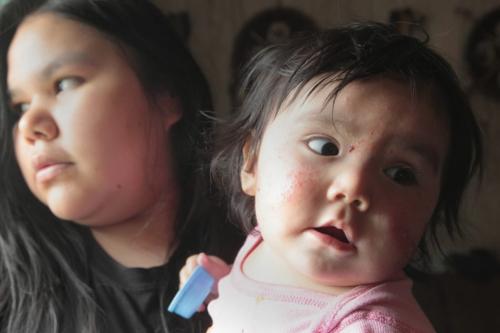 JOE.BRYKSA@FREEPRESS.MB.CA NO RUNNING WATER FEATURE-(See Helen's story)  -   Mother Larissa Harper with child Lyra at Red Sucker Lake First Nation. In homes with no running water, it's hard for rashes to heal. July 2010, - JOE BRYKSA/WINNIPEG FREE PRESS
