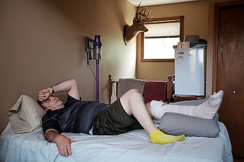 Randy Wood is recovering at home after breaking his leg on a dirt bike ride near Camp Hughes east of Carberry and spending more than 24 hours in the bush before he was found. (Tim Smith/The Brandon Sun)