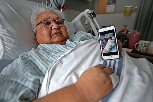 Souris resident Lucy Demeria shows a picture of her bandaged arm from an injury she sustained after falling from a handi-transit lift in that community last October. Though she is doing better, she has had to remain in hospital recuperating since that time. (Matt Goerzen/The Brandon Sun)