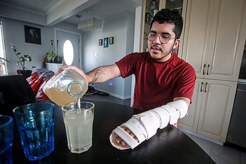 JOHN WOODS / FREE PRESS
Ariel Martes, who was robbed at gunpoint and attacked with a machete two weeks ago is photographed in his home Sunday October 27, 2024. 

Reporter: ?